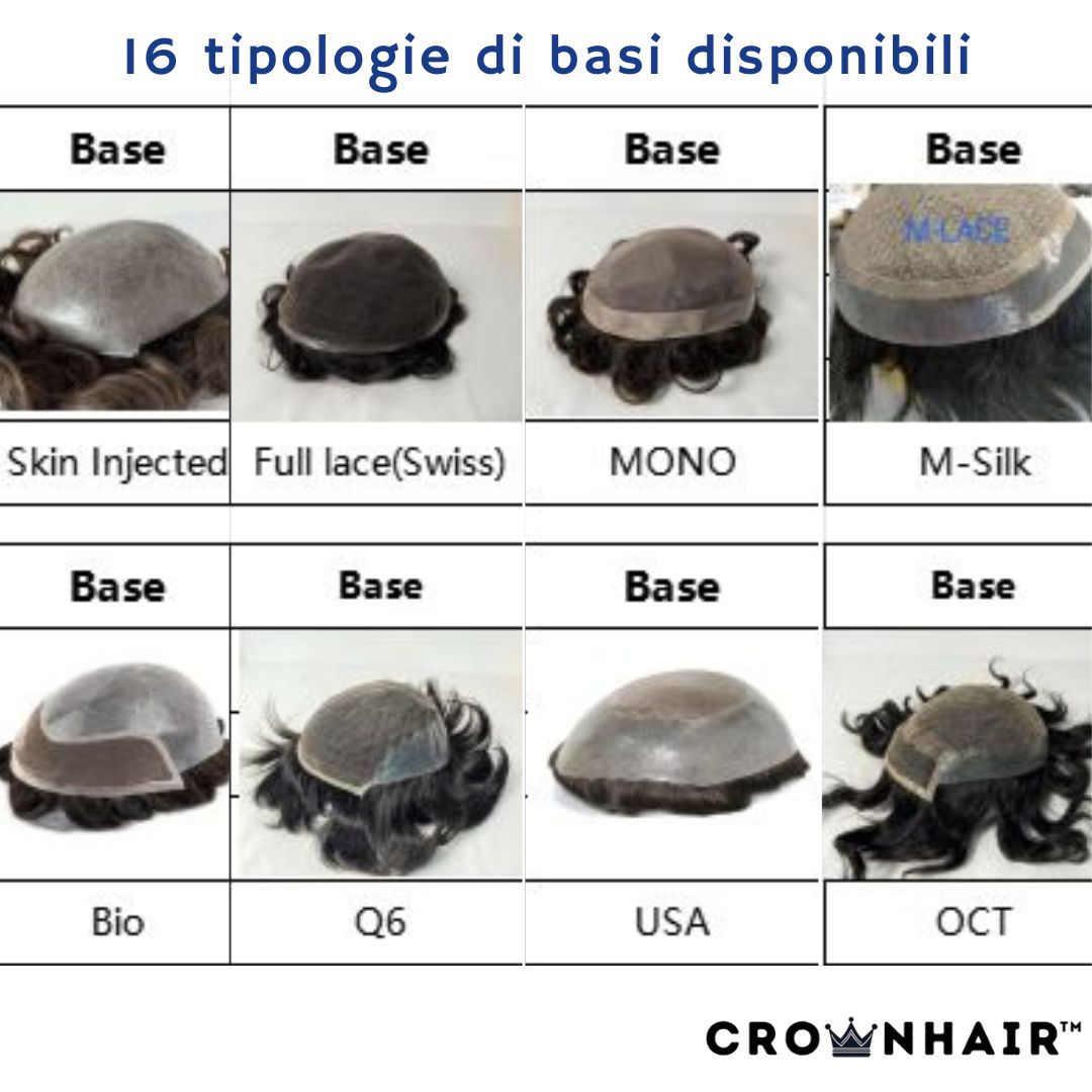 CrownHair™️ Custom - Impianto Capillare su Misura