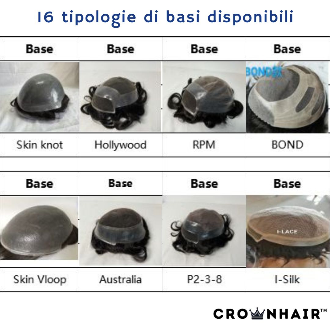 CrownHair™️ Custom - Impianto Capillare su Misura