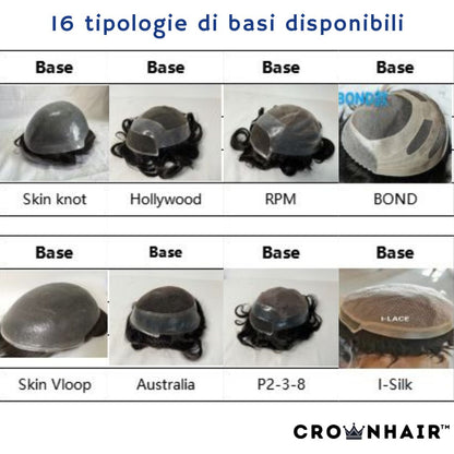 Impianto Capillare su Misura