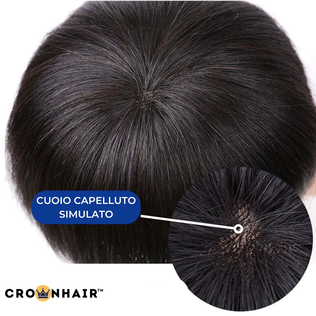 Crownhair™️ Pro-Patch 2.0 Ultra Skin Professional line